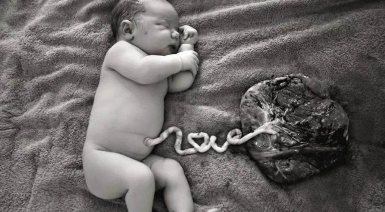 Napanuoran veren luovuttaminen voi pelastaa elämän