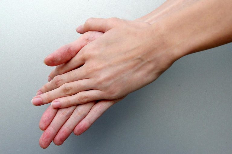 Jokainen meistä voi levittää bakteereita