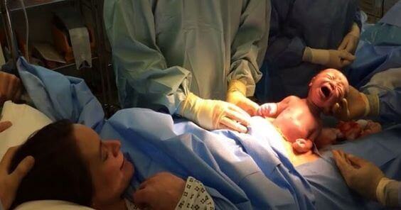 Keisarileikkaus ei ole helppo tapa synnyttää