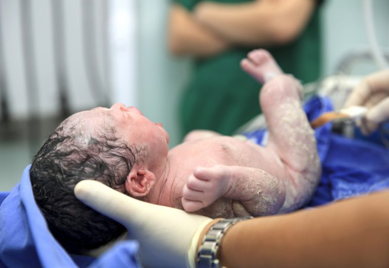Erilaiset synnytystavat - 9 tapaa saattaa vauva maailmaan