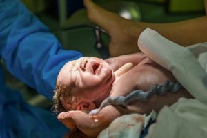 Napanuoran lahjoittaminen synnytyksen jälkeen
