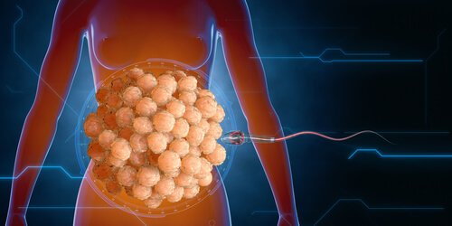 Sperma taistelee eloonjäämisestä