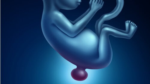 Spina bifida eli selkärankahalkio