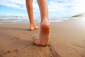 Lapsen länkisääret: Syyt ja hoito