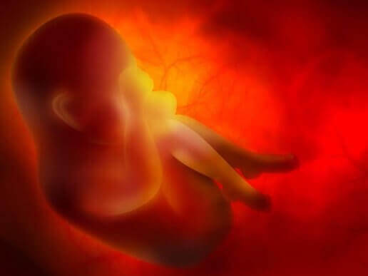 Sikiön ympärille kiertynyt napanuora raskauden ja synnytyksen aikana