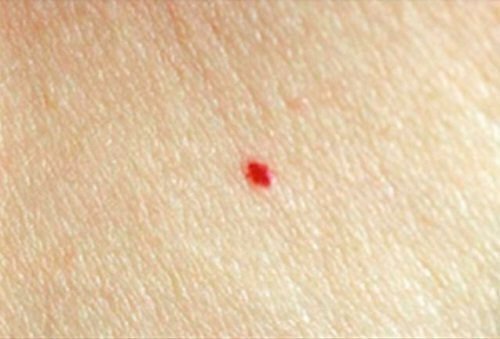 Eri tyyppiset luomet ja niiden tunnistaminen