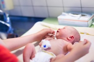 Näin hoidat vastasyntyneen napatynkää