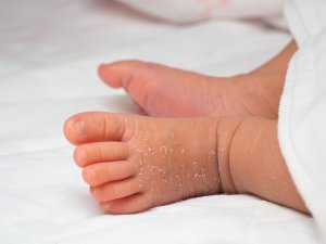 Kuinka vastasyntyneen ihoa kannattaa hoitaa?