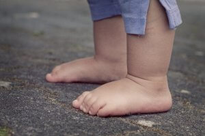 Lapsen akondroplasia