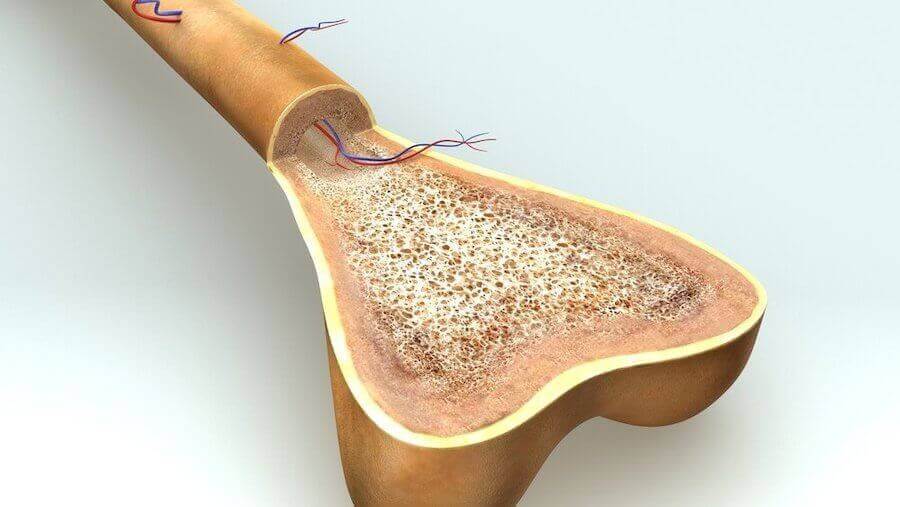 Lapsen akondroplasia