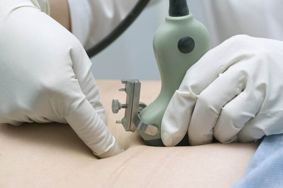 Millaisia ongelmia lapsiveden vähyys voi aiheuttaa?