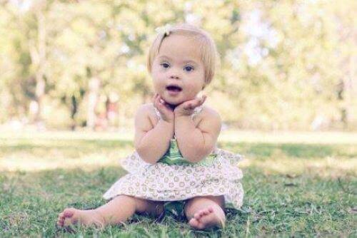 Downin syndrooma on tunnetuin kromosomihäiriö