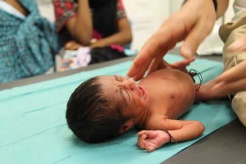 Alhainen syntymäpaino ja sen vaikutukset lapsen terveyteen
