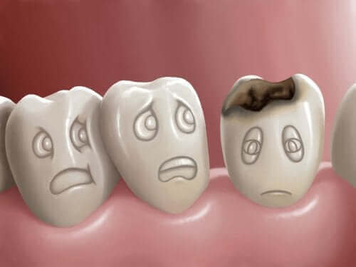 Hampaiden reikiintyminen ja sen ehkäiseminen