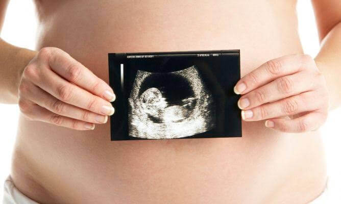 Osittainen keskenmeno tarkoittaa tilannetta, jossa osa kehittyvistä sikiöistä menehtyy kesken raskauden
