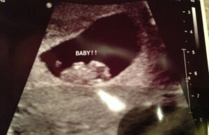 Ramzi-metodi vauvan sukupuolen selvittämiseksi