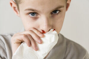 Mistä lapsen nenäverenvuoto johtuu ja miten sitä hoidetaan?