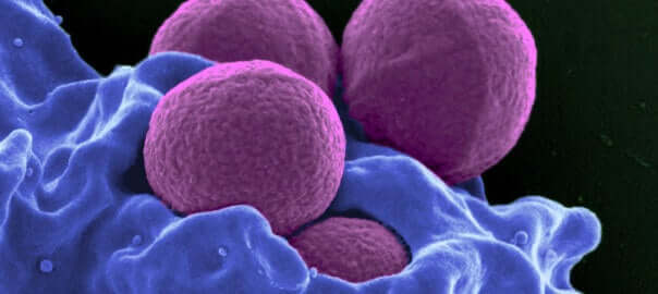 Alhaiset neutrofiiliarvot tarkoittavat alhaista valkosolujen määrää veressä.