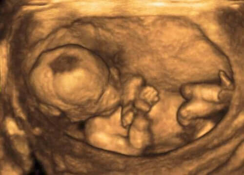 Asiantuntijat voivat ultraäänitutkimuksen avulla havaita mahdolliset lapsiveteen liittyvät ongelmat