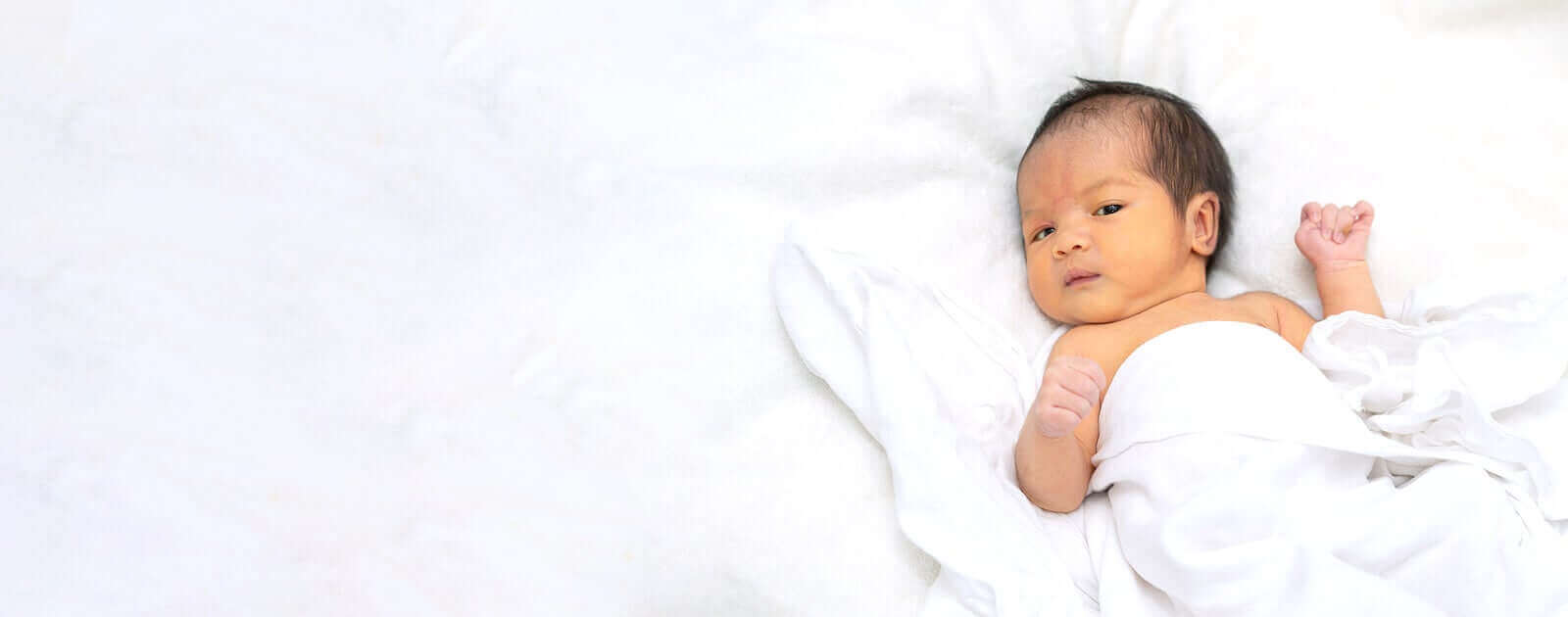 Mikä on Kabuki-oireyhtymä?