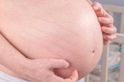 10 kotihoitoa raskauden aikaiseen kutinaan