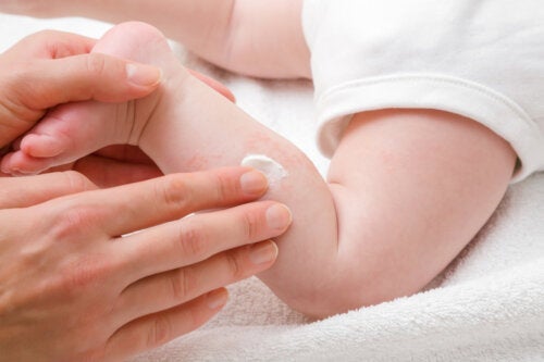 10 luonnollista keinoa hoitaa vauvan kuivaa ihoa