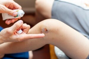 Kuinka hoitaa lapsen tulehtunutta haavaa?