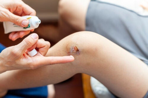 Kuinka hoitaa lapsen tulehtunutta haavaa?