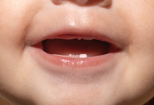 Lapsen ensimmäinen hammaslääkärikäynti