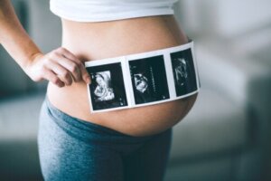 Kysymyksiä raskausajan ultraäänitutkimuksista